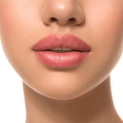 DERMAL FILLERS